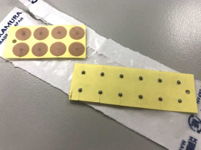 針灸可以治療什麼